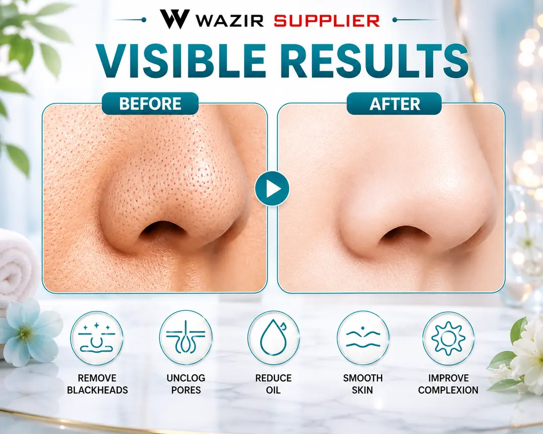 Black Head Remover Vacuum