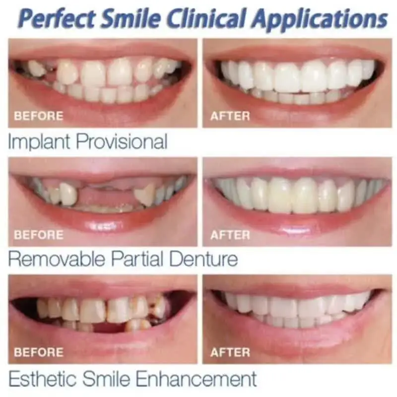 Teeth Whitening Snap On Fake Teeth