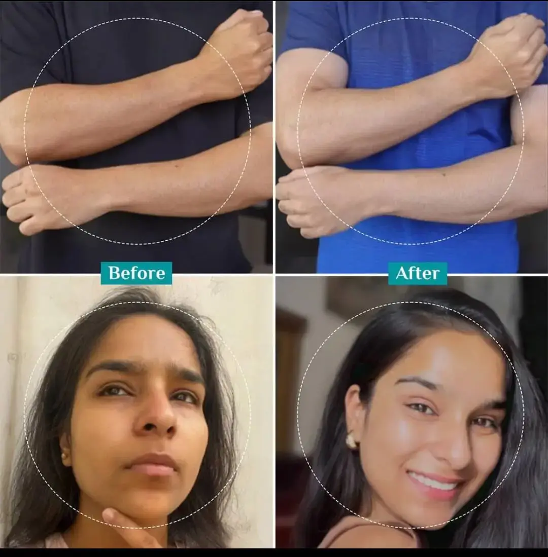 AHA 30% + BHA 2% Peeling Solution Face Serum