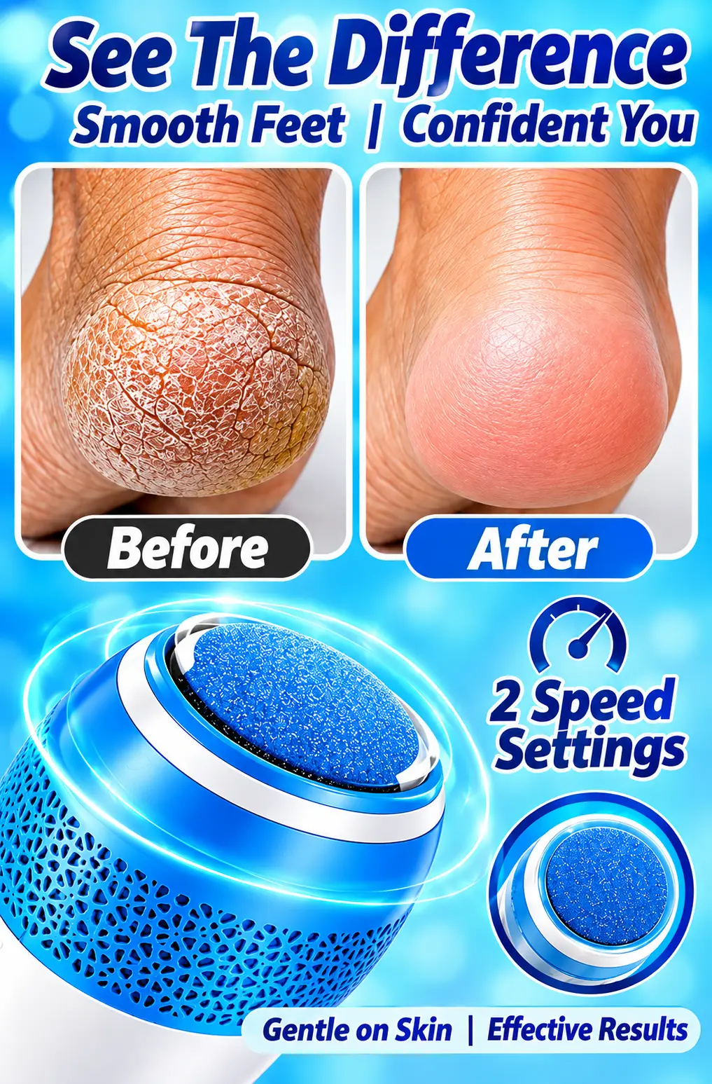 Electric Foot Callus Remover with Vacuum Dust Collection, LED Light, 2-Speed Rechargeable Pedicure & Dead Skin Remover