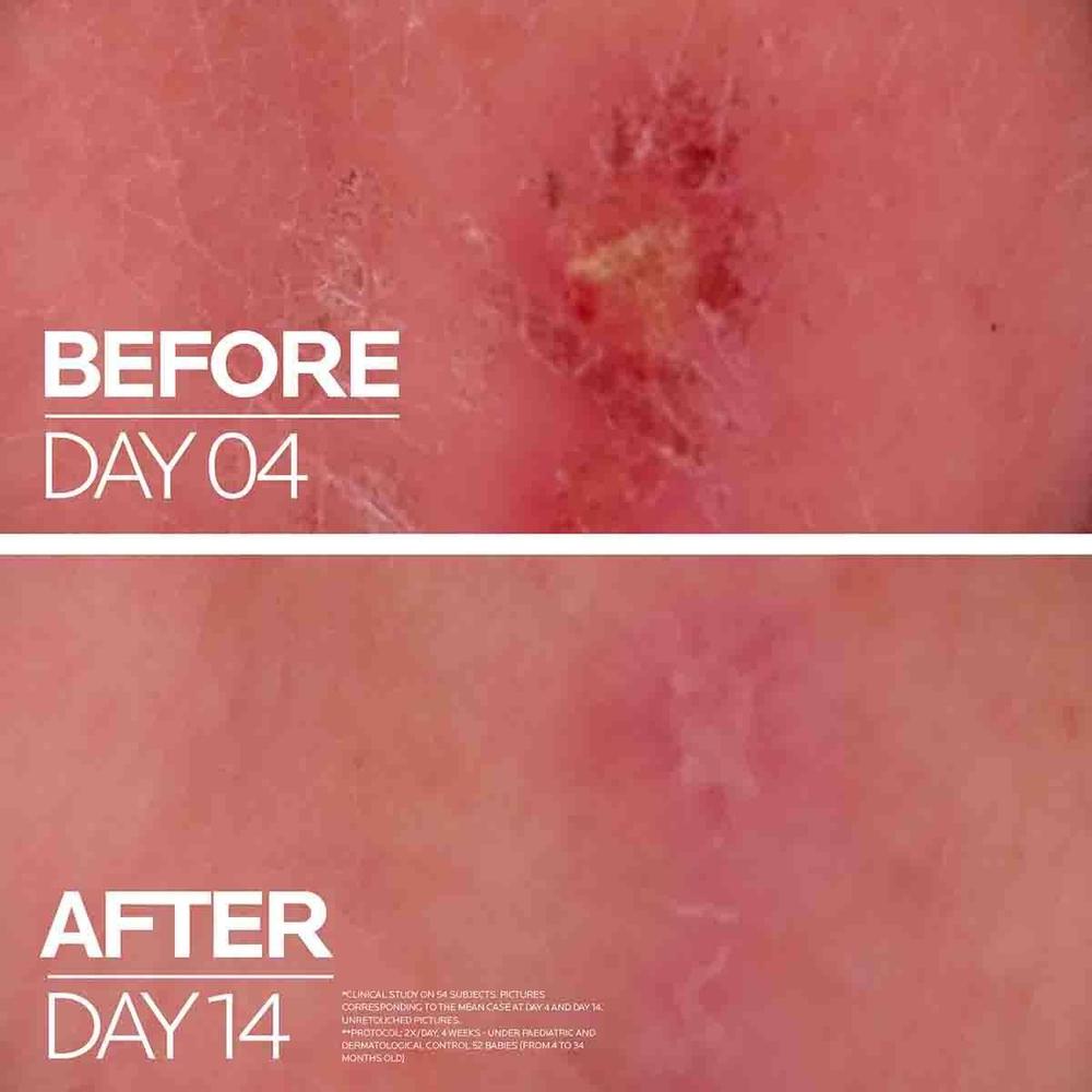 Hyaluronic Acid B5 Serum & Balm Pack 2 for Glowing Skin