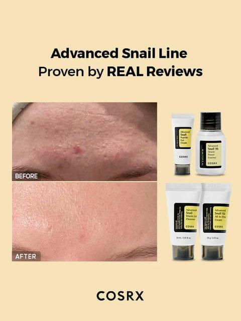 Snail Mucin Skincare Bundle for Glowing Skin