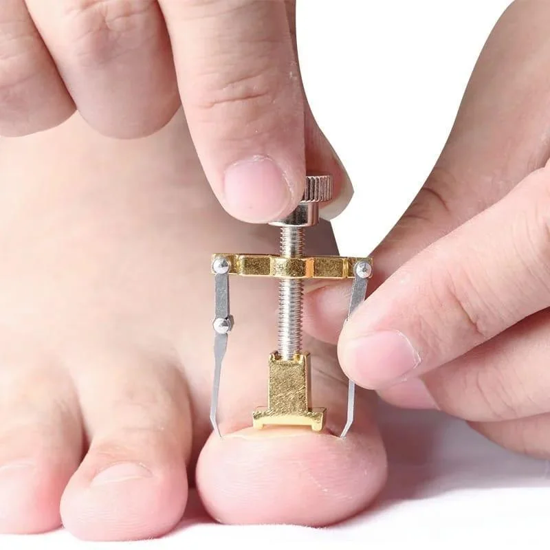 Ingrown Nail Correction Tool Golden Metal Travel Size