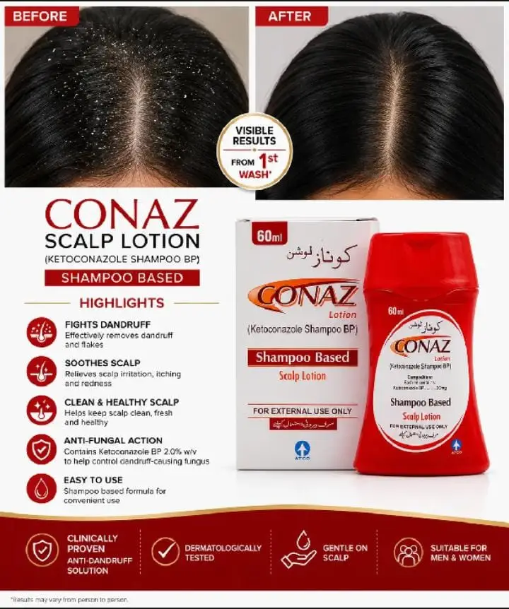 Conaz Shampo-For dandruf