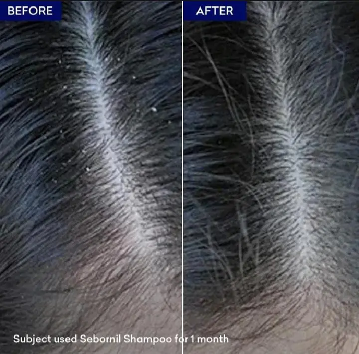 Sebornil Shampoo-100ml (Jenpharm)