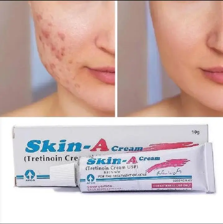 Skin-A Cream
