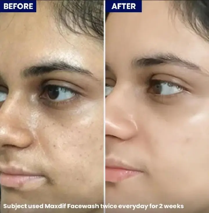 Maxdif Face Wash