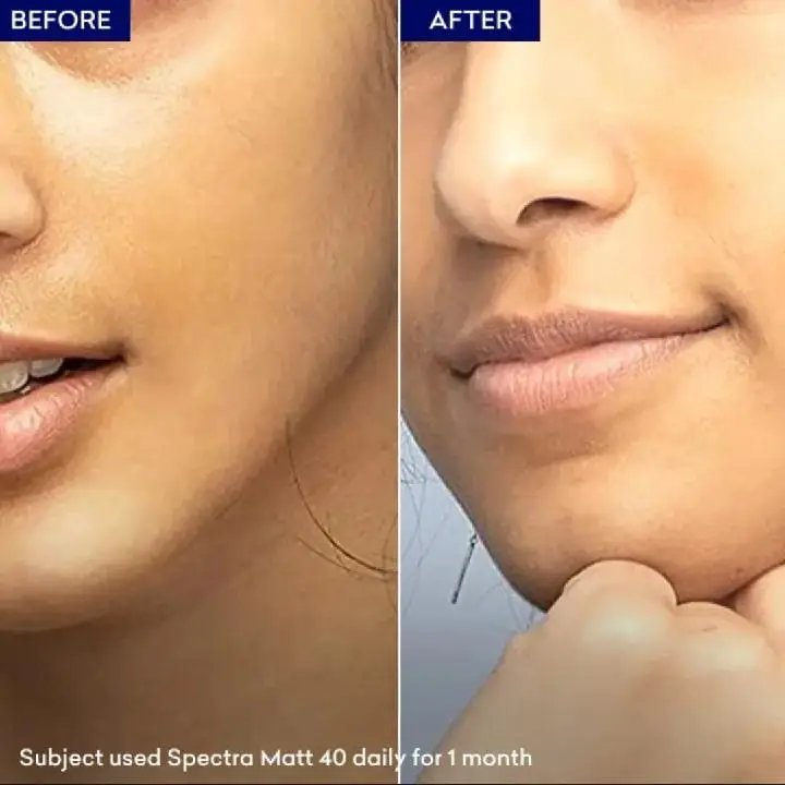 Spectra Matt-SPF50+ Gel