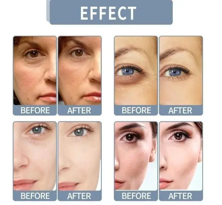 Up Town la Anti under eye Dark circle serum