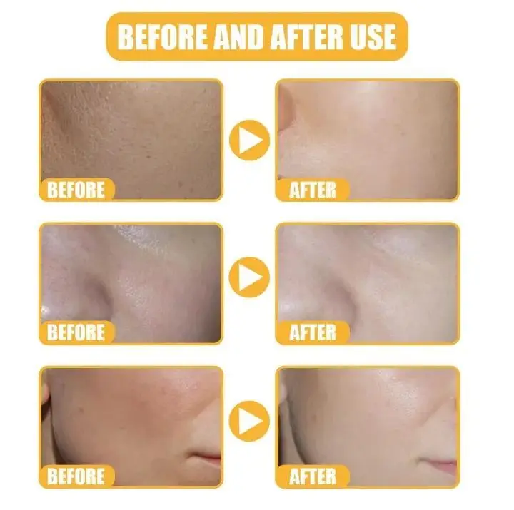 Up Town la White Rice Serum