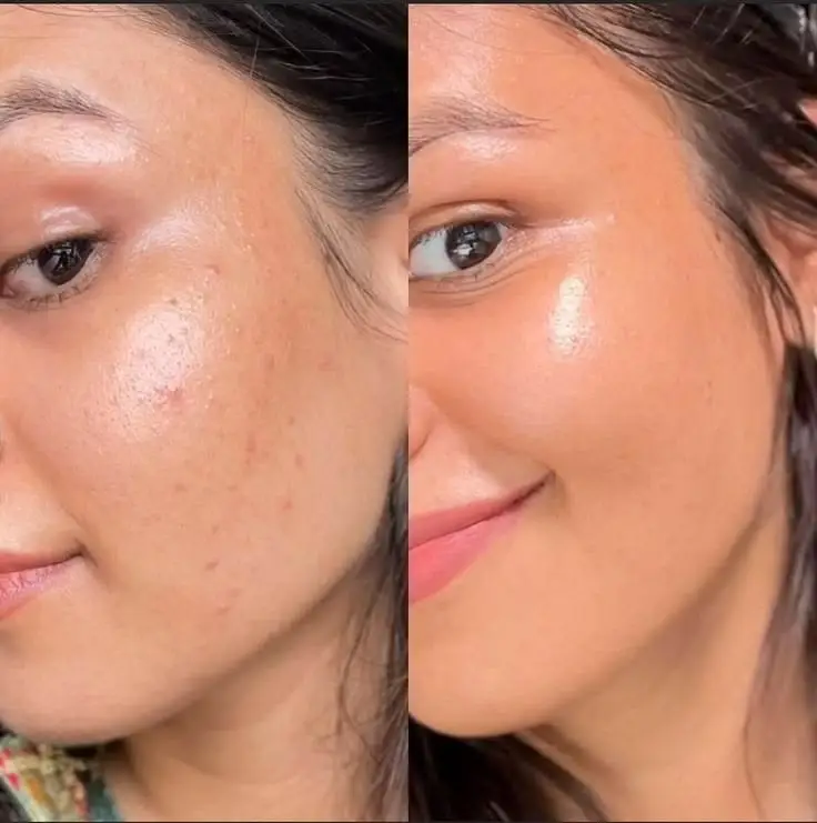 Glitter Skin Vitamin C Radiance Serum 30ml