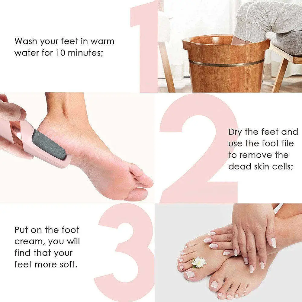 Electric Foot Callus Remover Rechargeable – Pedicure Dead Skin Remover for Heels & Feet – Portable Foot Care Tool