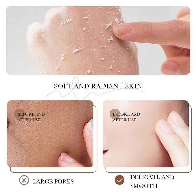 Exfoliator Exfoliating Gel