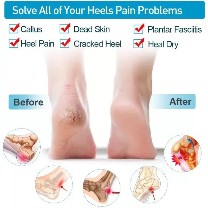 Silicone Heel Pads for Pain Relief & Anti Crack Heel