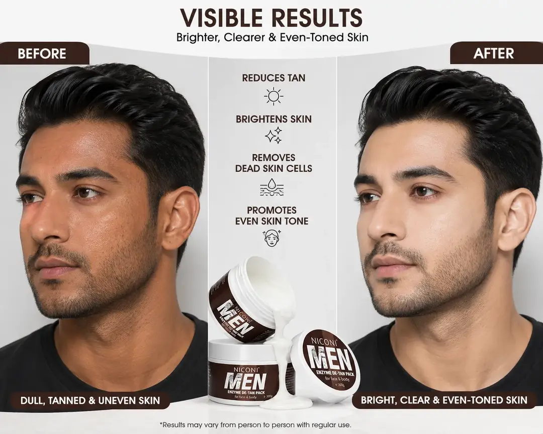 Niconi Whitening And Brightening Men Face Cream