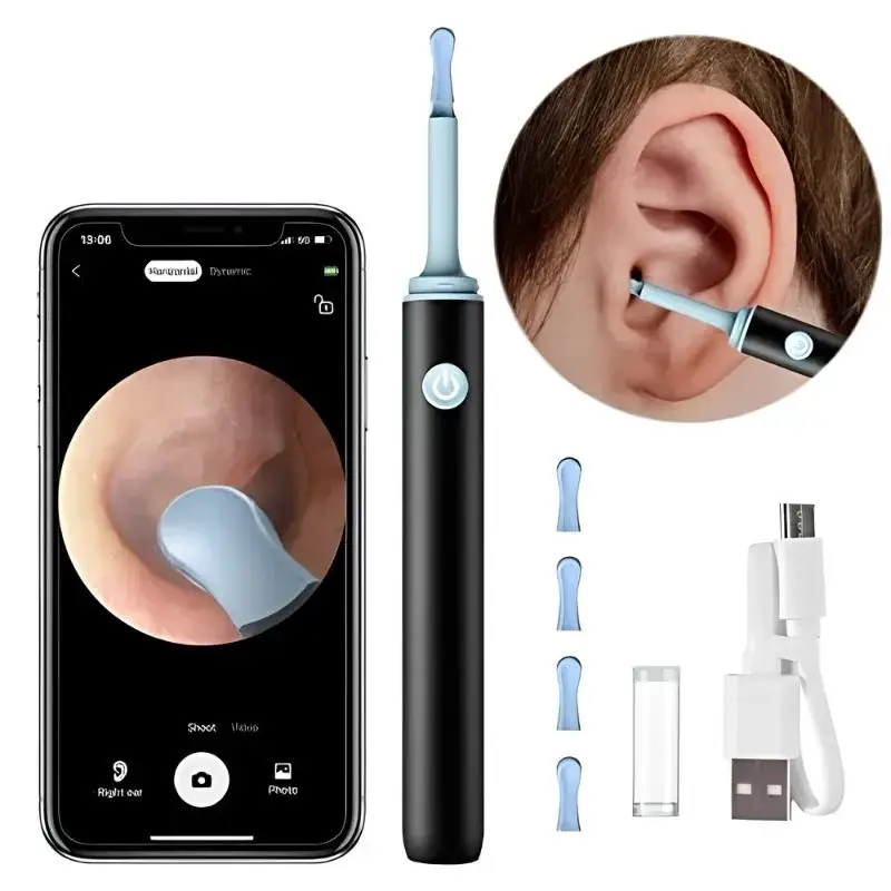 Smart Visual Ear Wax Cleaning Kit with HD Camera