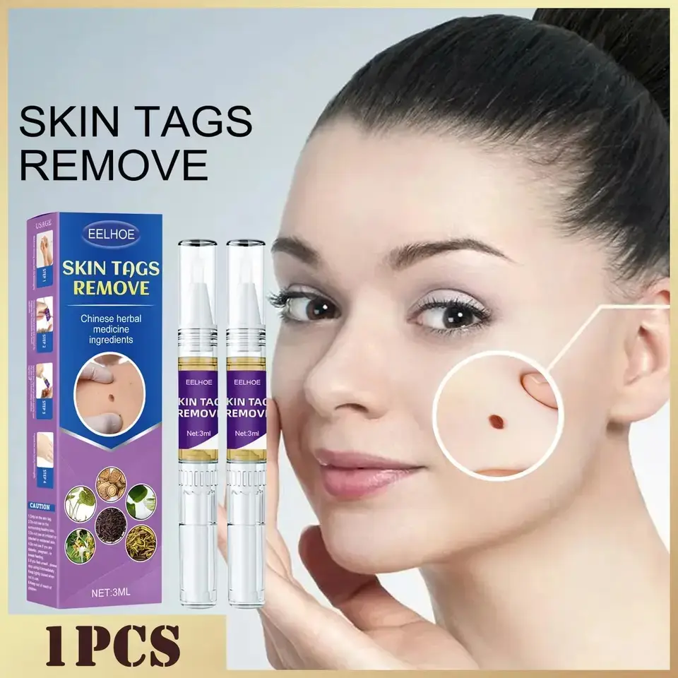 Skin Tag Warts Mole Remover Pen