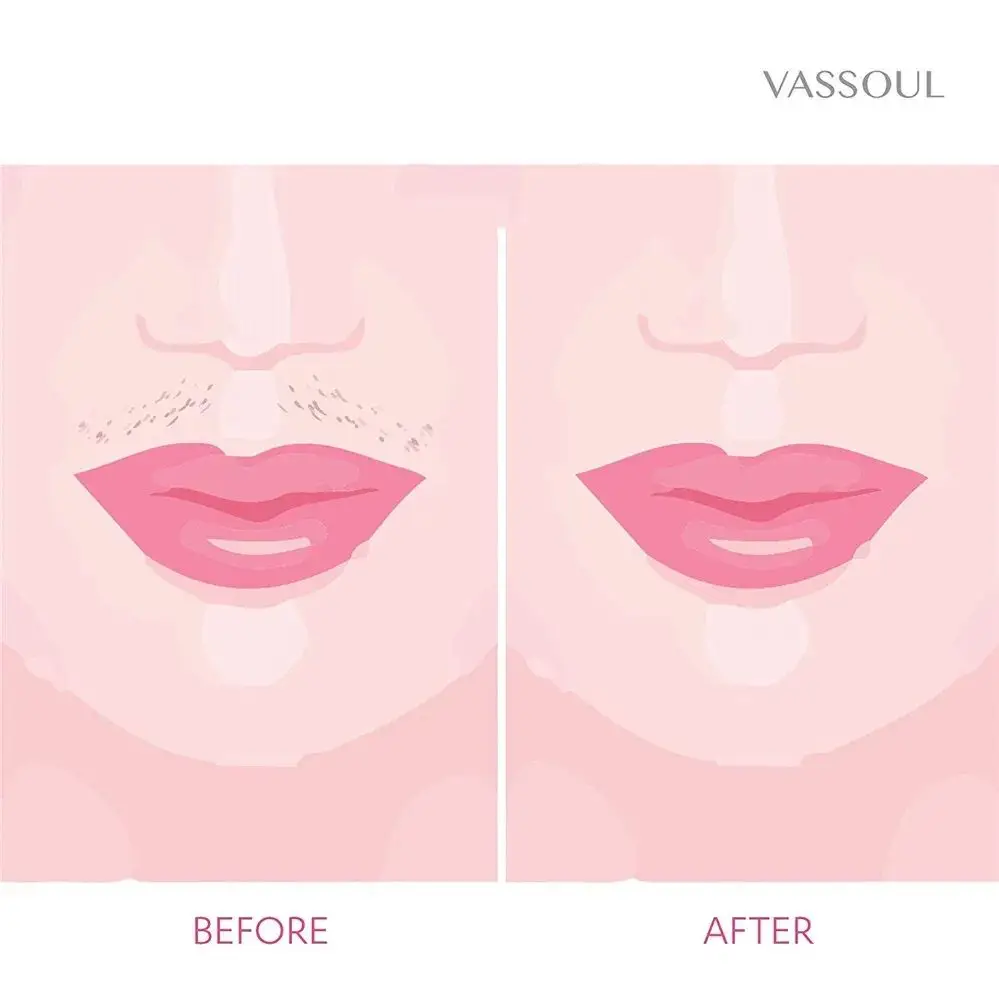Painless Hair Removal Hair Epilator