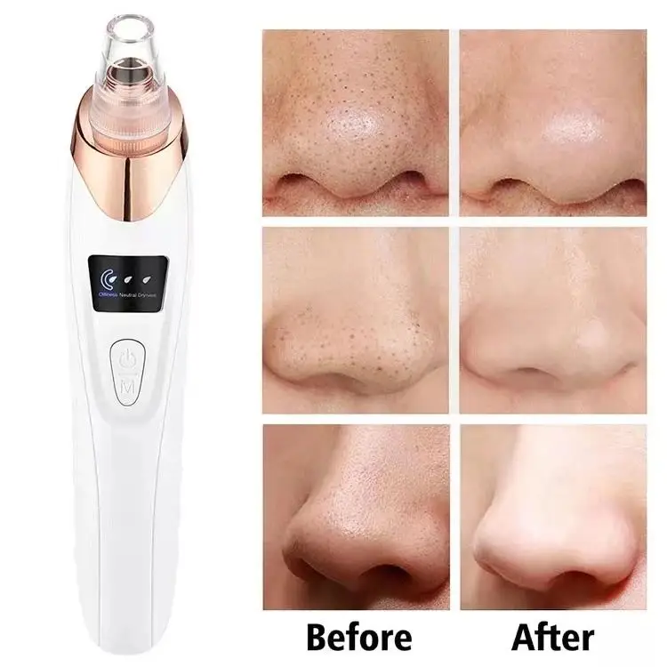 Personal Grooming Blackhead Removing Tool
