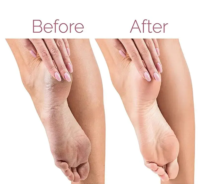 Personal Grooming Electric Foot Exfoliating Scrubber