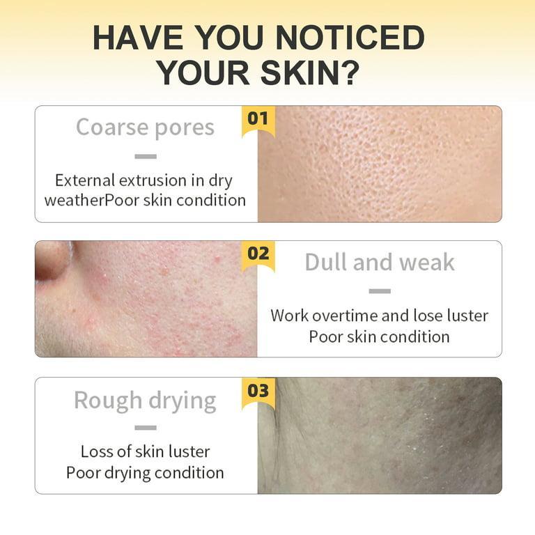 Turmeric Facial Mask for Acne Prone Skin Brightening & Clear