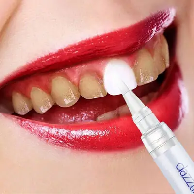 Dazzling White Instant Teeth Whitening Pen thumbnail 3