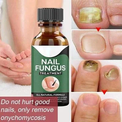 All Natural Nail Fungus Treatment Serum 1pc thumbnail 2