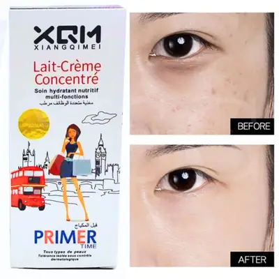 XQM Primer thumbnail 4
