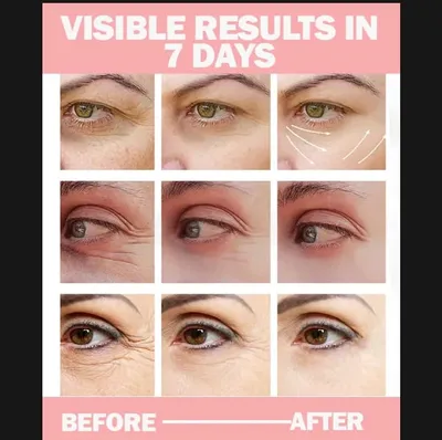 Dark Circles Eye Gel Cream 10ml Whitening thumbnail 4