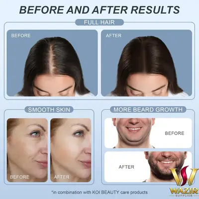 Hair Growth Derma Stemp