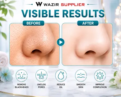 Black Head Remover Vacuum thumbnail 5