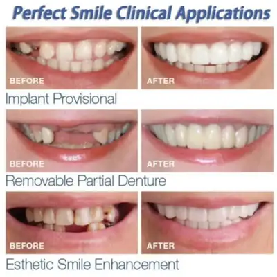 Teeth Whitening Snap On Fake Teeth thumbnail 2