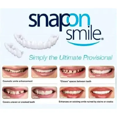 Teeth Whitening Snap On Fake Teeth thumbnail 4