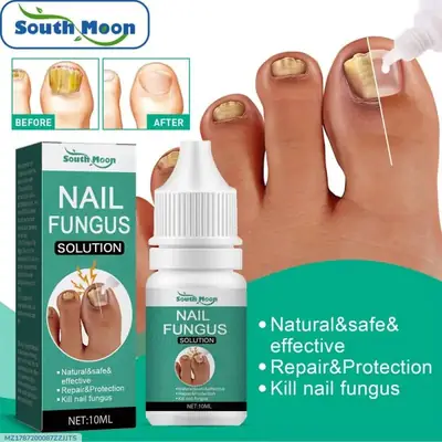 Fast Nail Fungal Treatments Nail Repair Essences Serum Care Treatments Foot Nail Fungus