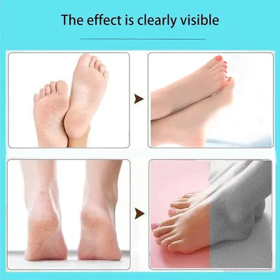 Electric Foot Exfoliating Scrubber thumbnail 6