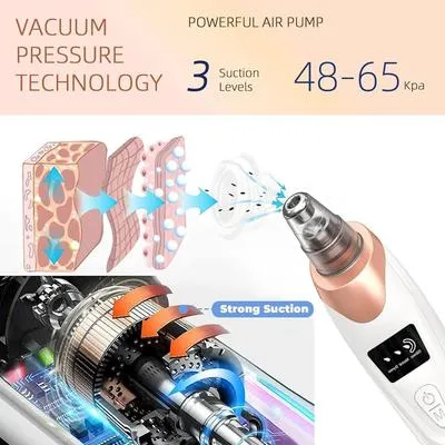 5-in-1 Electric Blackhead Remover USB Rechargeable thumbnail 4
