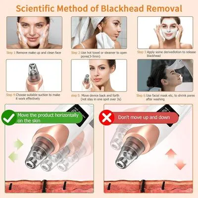 5-in-1 Electric Blackhead Remover USB Rechargeable thumbnail 5