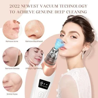 5-in-1 Electric Blackhead Remover USB Rechargeable thumbnail 6