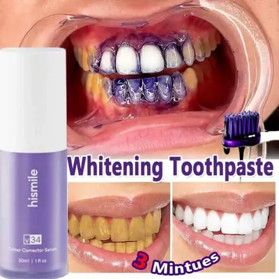 Teeth Whitening V34 Colour Corrector Serum - Purple Toothpaste 1   Hismile V34 Purple Toothpaste, Teeth Whitening Kit, Hismile Toothpaste & Teeth Whitening Strips, Color Corrector Oral Mousse, Whitening Serum (30ml)