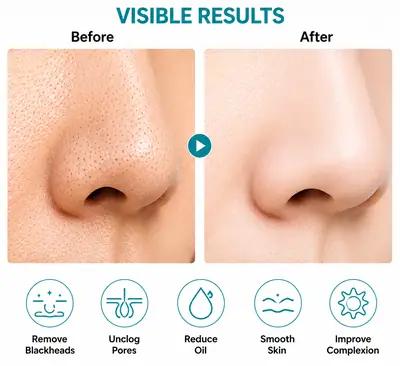 Blueidea Blackhead Remover Vacuum – Electric Facial Pore Cleaner (BLD-2005) thumbnail 6
