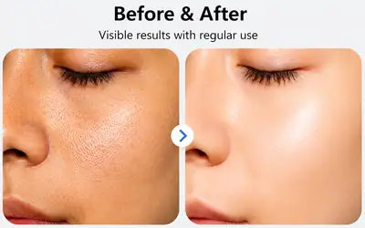 Dust-Free Blonder: A specially formulated blonder that lightens and brightens the skin, helping to even out the complexion. Black Head Remover 250 30 thumbnail 4