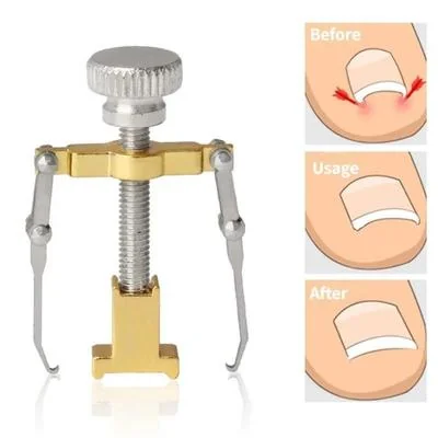 Ingrown Nail Correction Tool Golden Metal Travel Size thumbnail 6