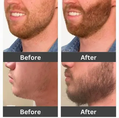 Hair Max Spray-60ml thumbnail 6