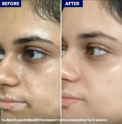 Maxdif Face Wash  thumbnail 4