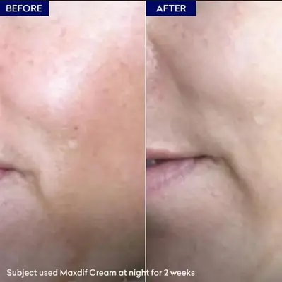 Maxdif Whitinging Cream-Jenpharm thumbnail 5