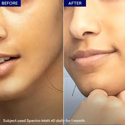 Spectra Matt-SPF50+ Gel thumbnail 2