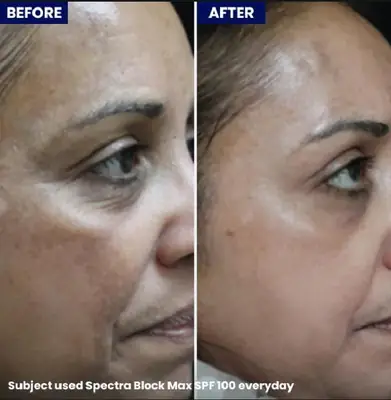 Spectra Block Max-SPF100+ Jenpharm thumbnail 4