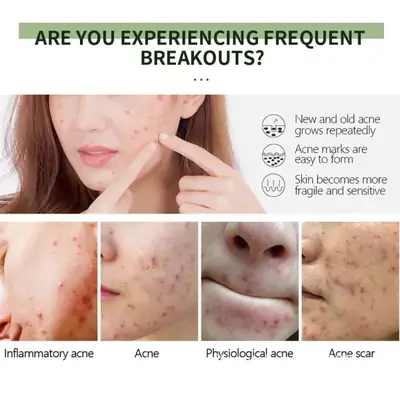 Anti-Aging Exfoliating Gel