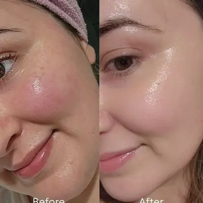 Glitter Skin Glutathione Brightening Serum 30ml thumbnail 2