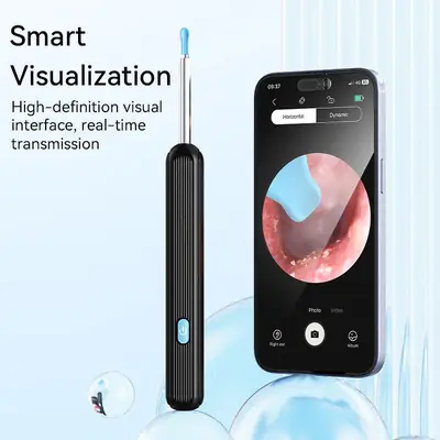 Smart Visual Ear Cleaner with HD Camera | WiFi Ear Wax Removal Tool | USB Type-C Rechargeable Otoscope | Compatible with Android & iOS thumbnail 5